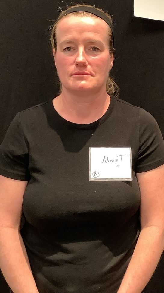 Dermal Filler Before & After