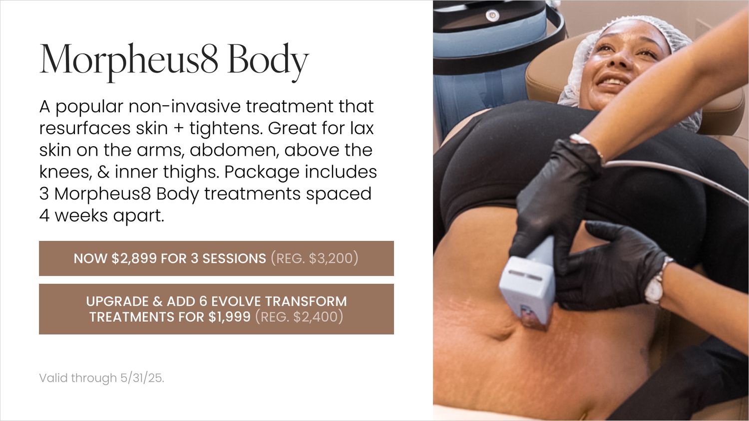 Morpheus8 Body skin treatment session promotion.